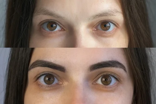 Brow lift et teinture avant après