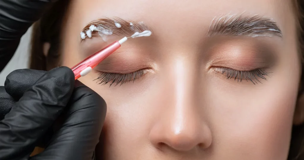 Brow lift